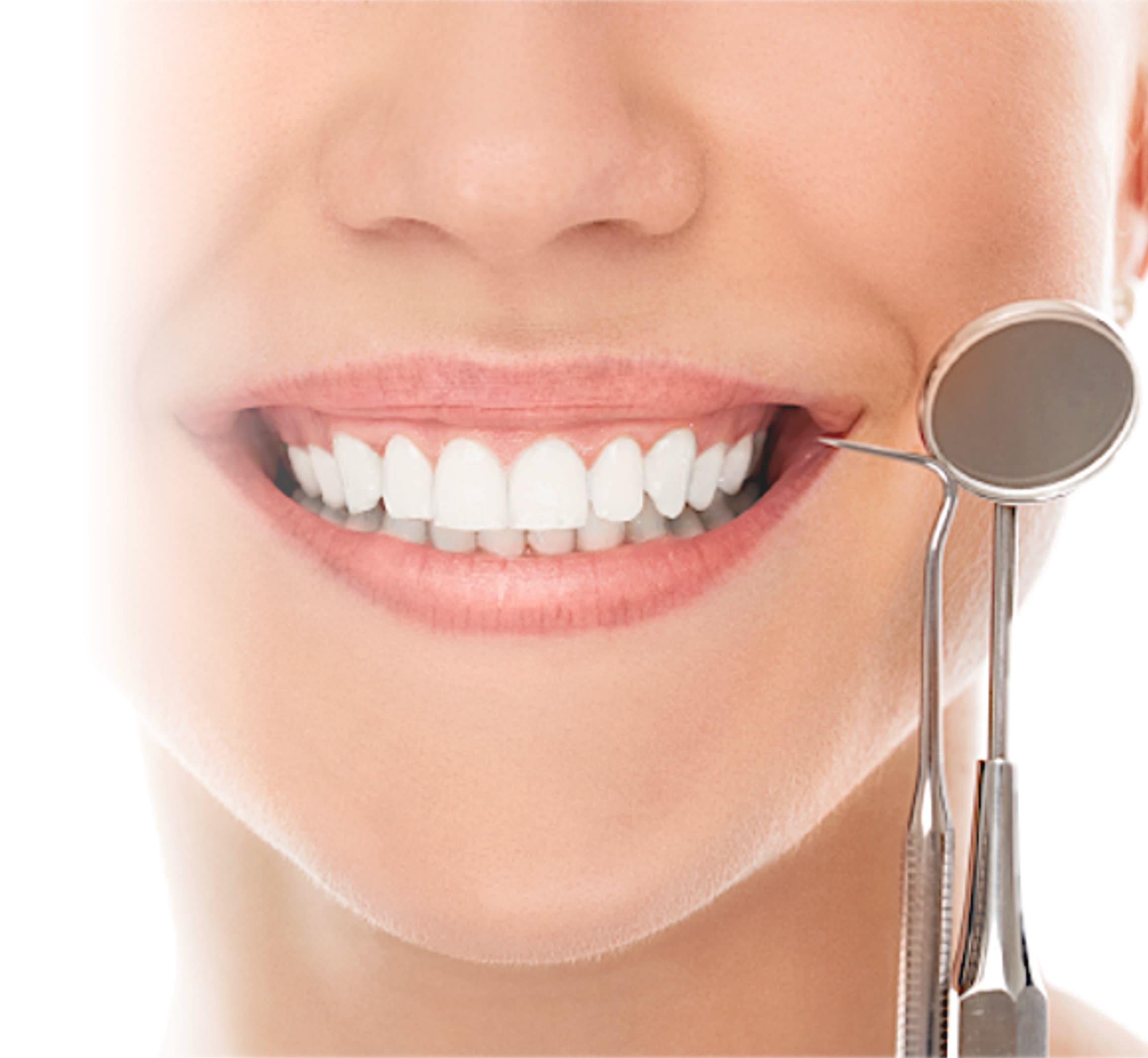 Limpeza dental - Odonto Yamada