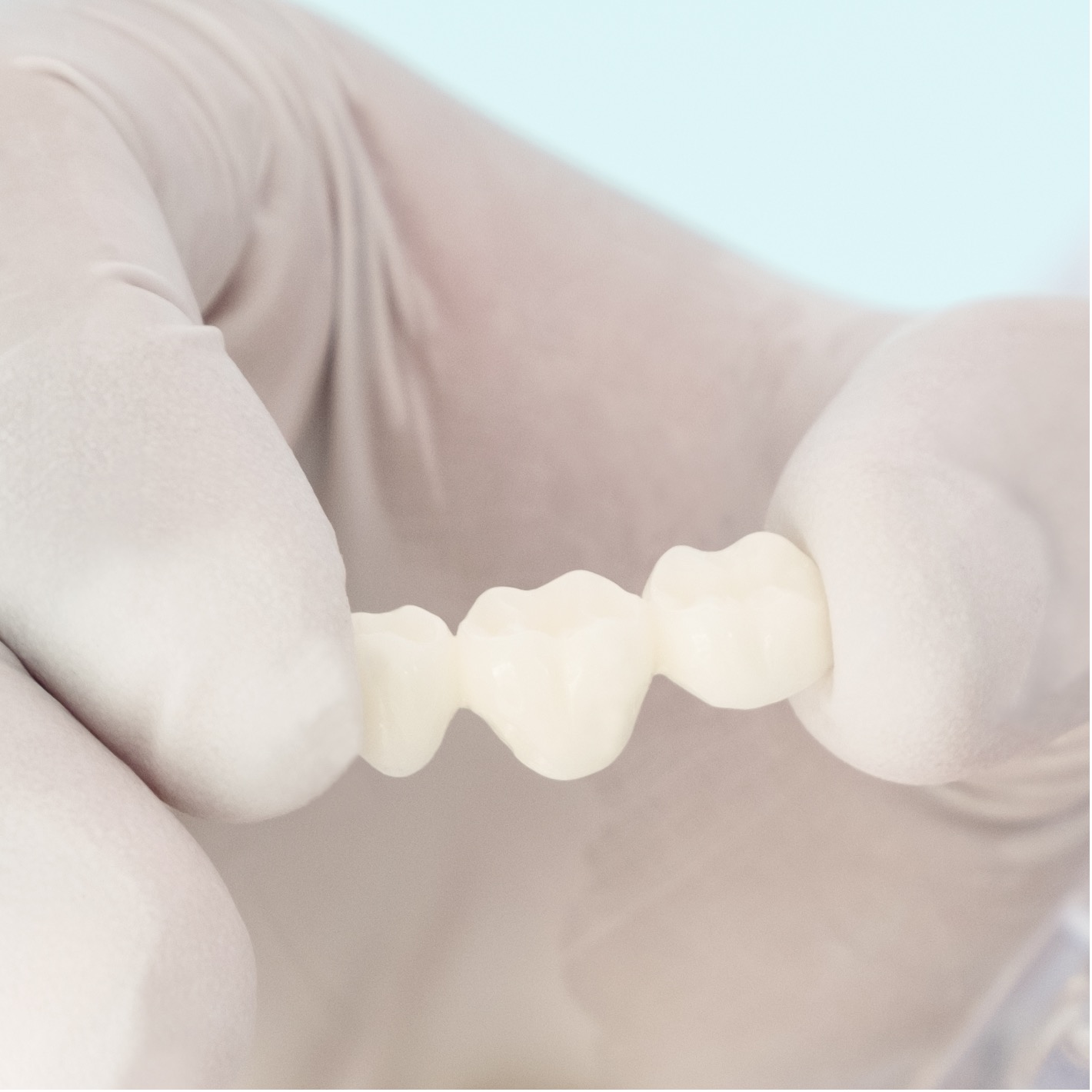 Ponte fixa - Odonto Yamada