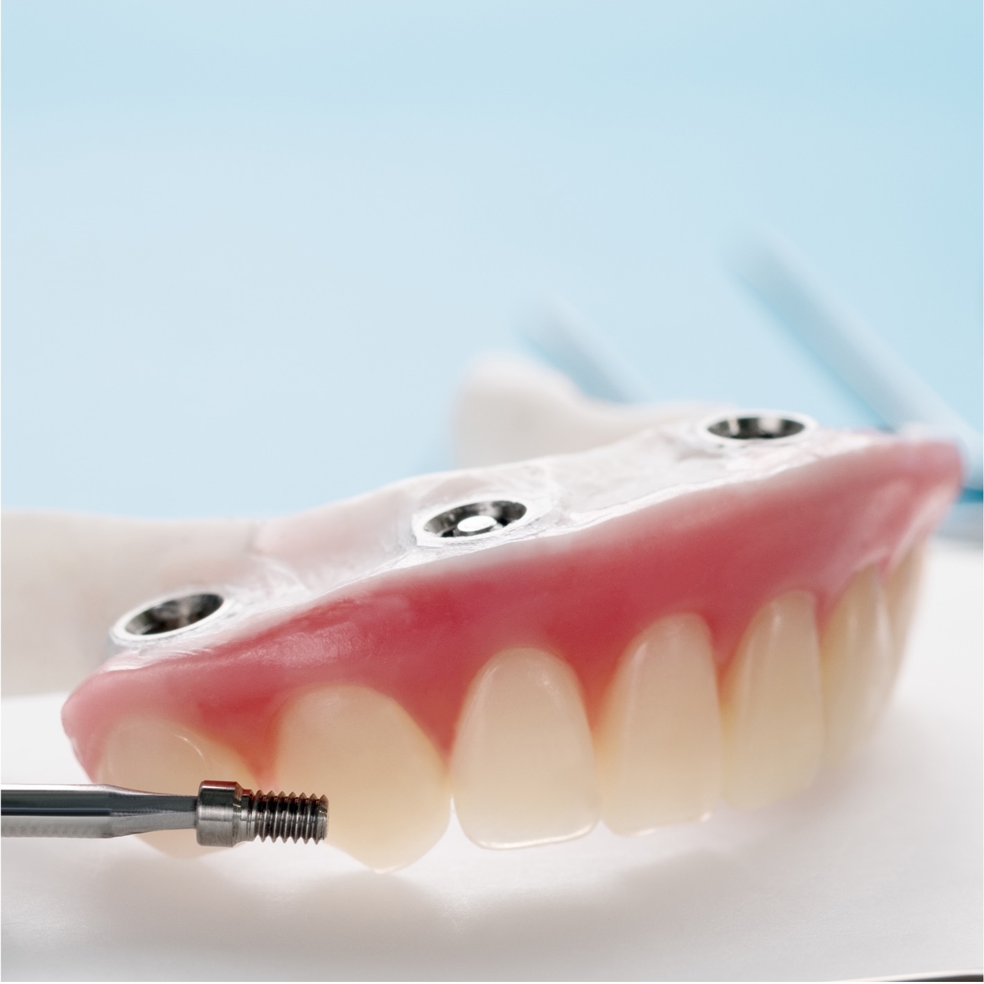 Prótese overdenture - Odonto Yamada