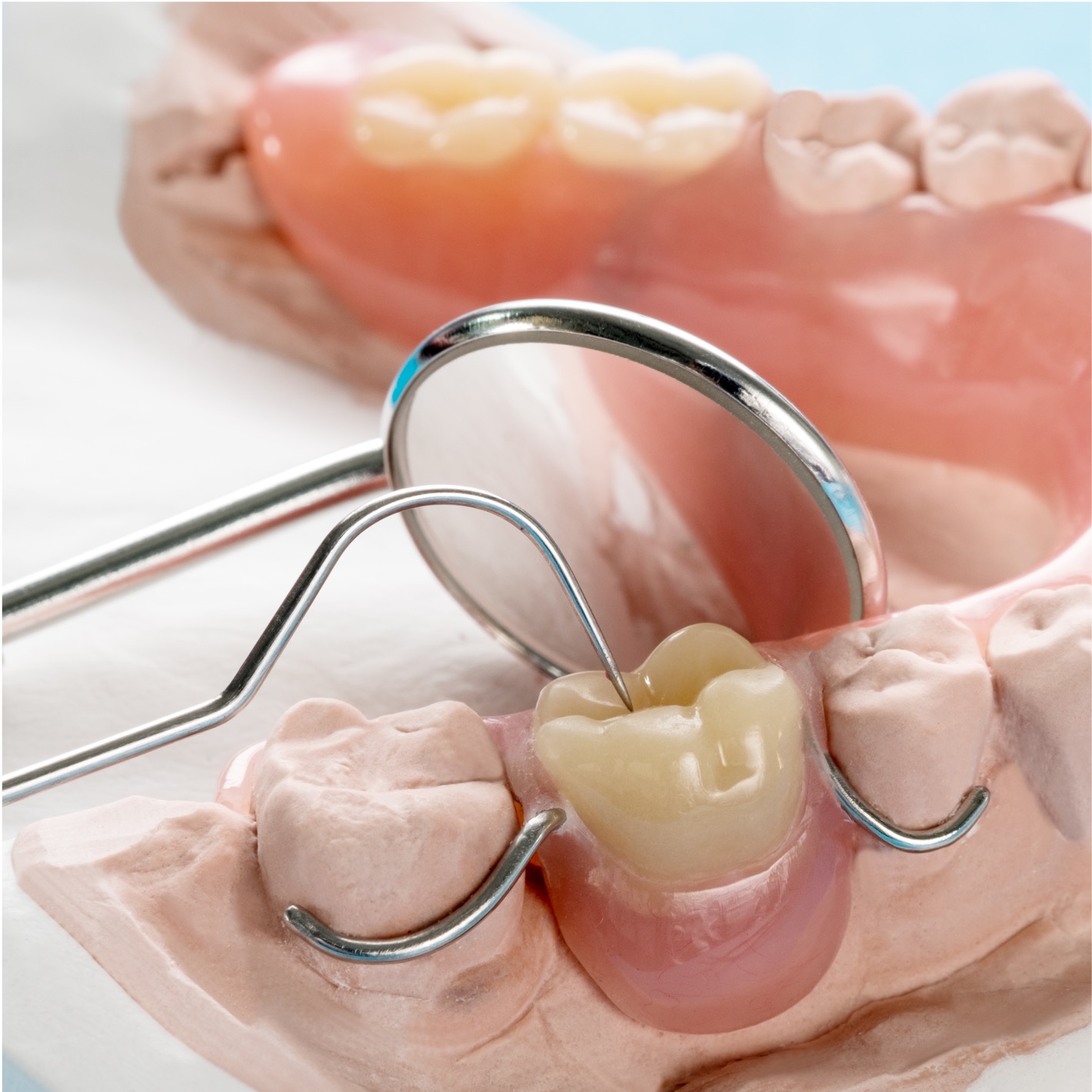 Prótese parcial removível - Odonto Yamada