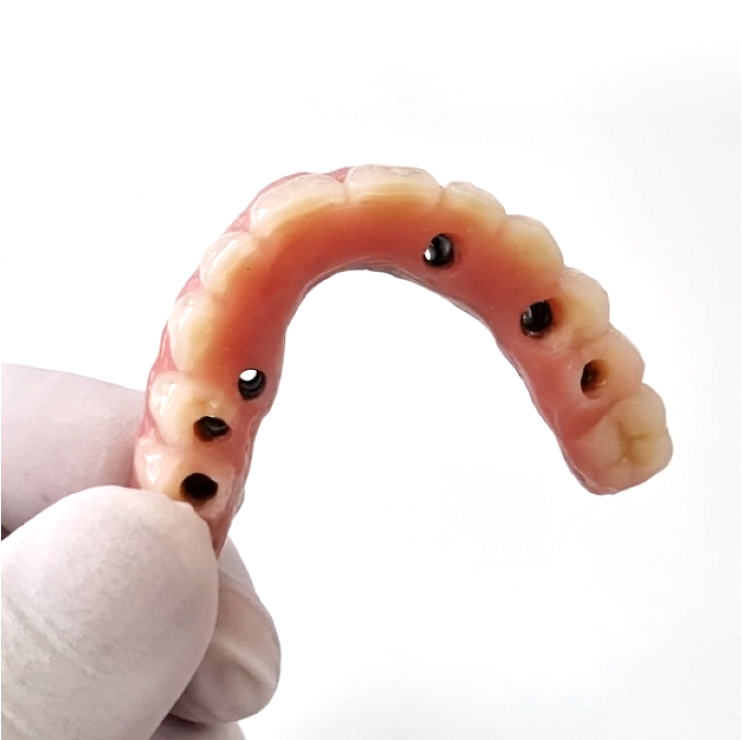 Prótese protocolo - Odonto Yamada