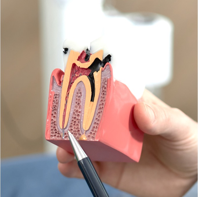 Serviço de endodontia - Odonto Yamada