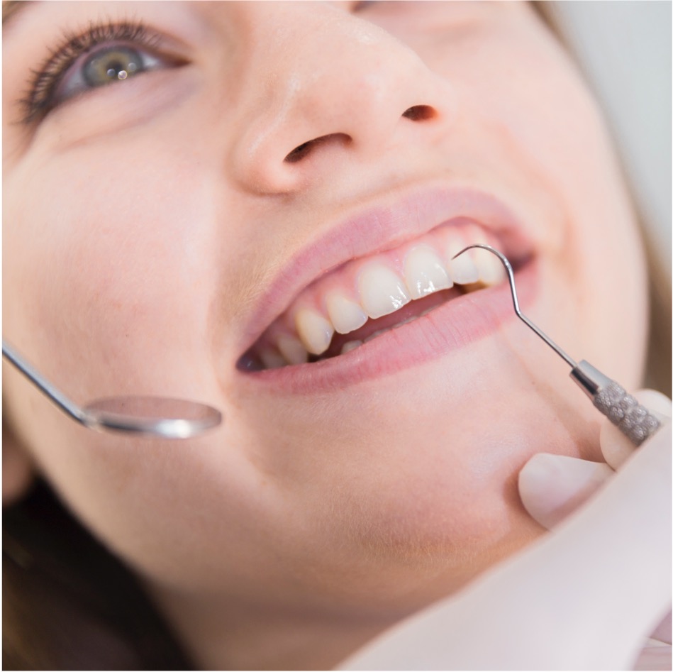 Limpeza dental de rotina - Odonto Yamada