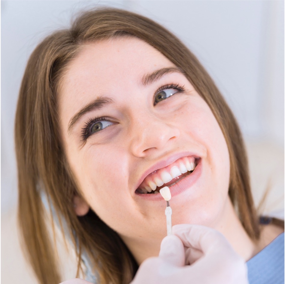 Facetas de Porcelana da Odonto Yamada