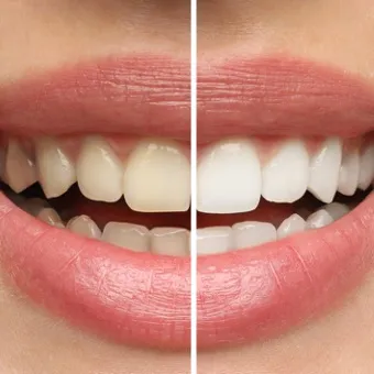 Serviço de odontologia estética - Odonto Yamada